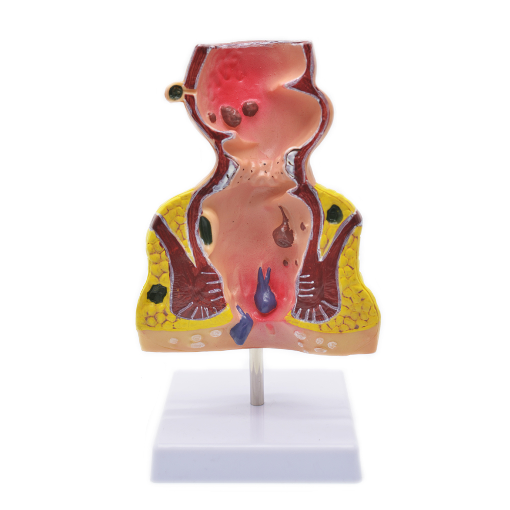 Modelo anatómico de recto humano