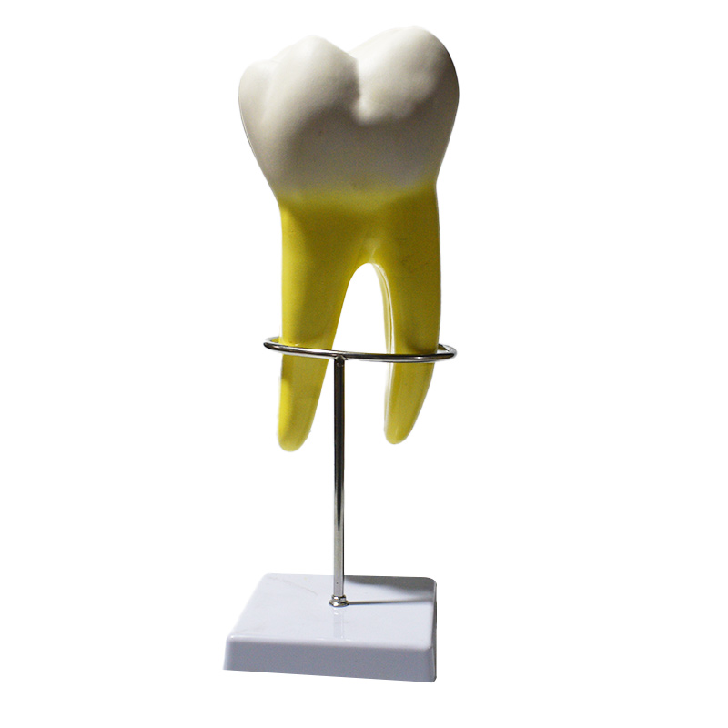 Modelo de molar superior de tres raíces